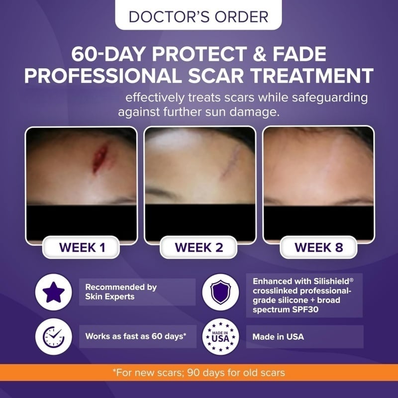 Skin Scar Solutions🛡️ 60% Silicone Scar Stick.