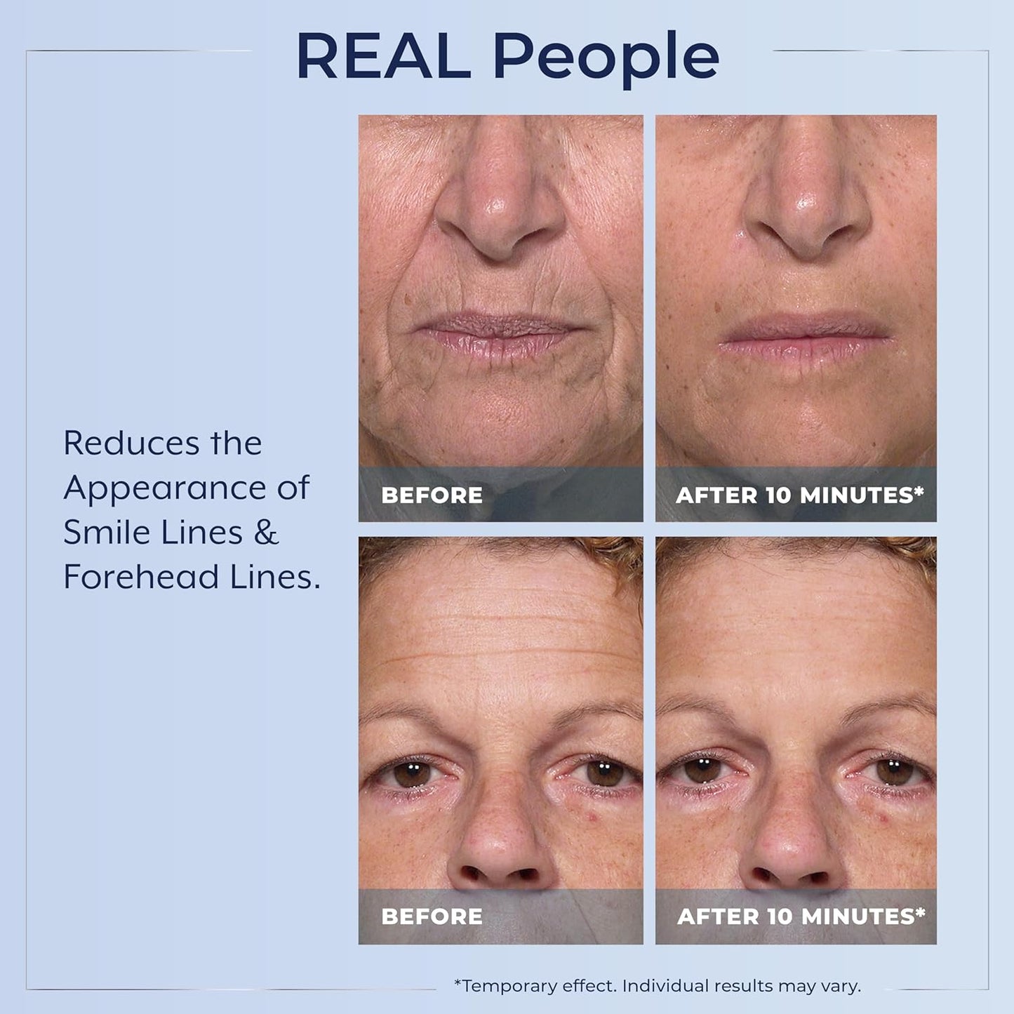 🌟 Prexdren® Rapid Reduction Eye Serum — Instantly reduces eye bags, wrinkles, and dark circles