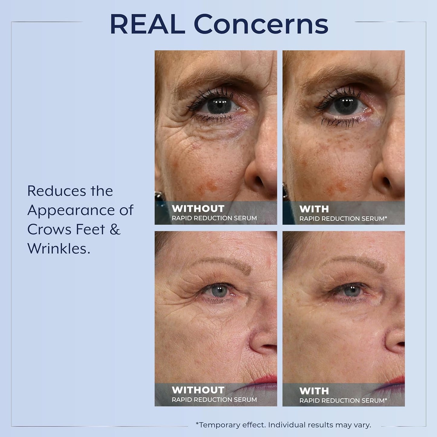 🌟 Prexdren® Rapid Reduction Eye Serum — Instantly reduces eye bags, wrinkles, and dark circles