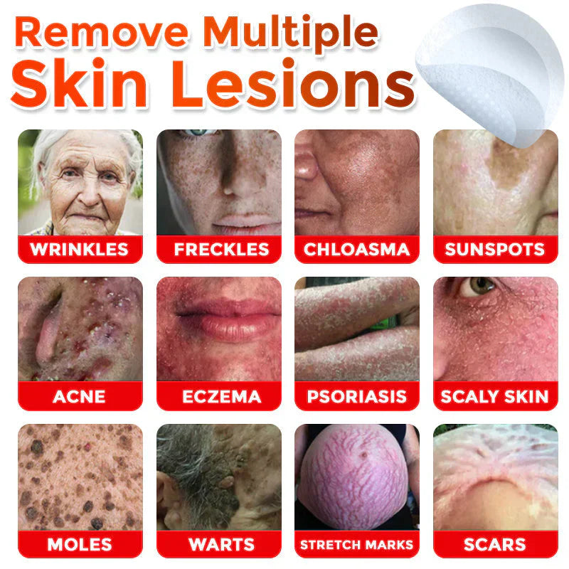 🌈LOVILDS® MicroNeedle Botanic Skin Tag Removal Patch (Made in the USA)