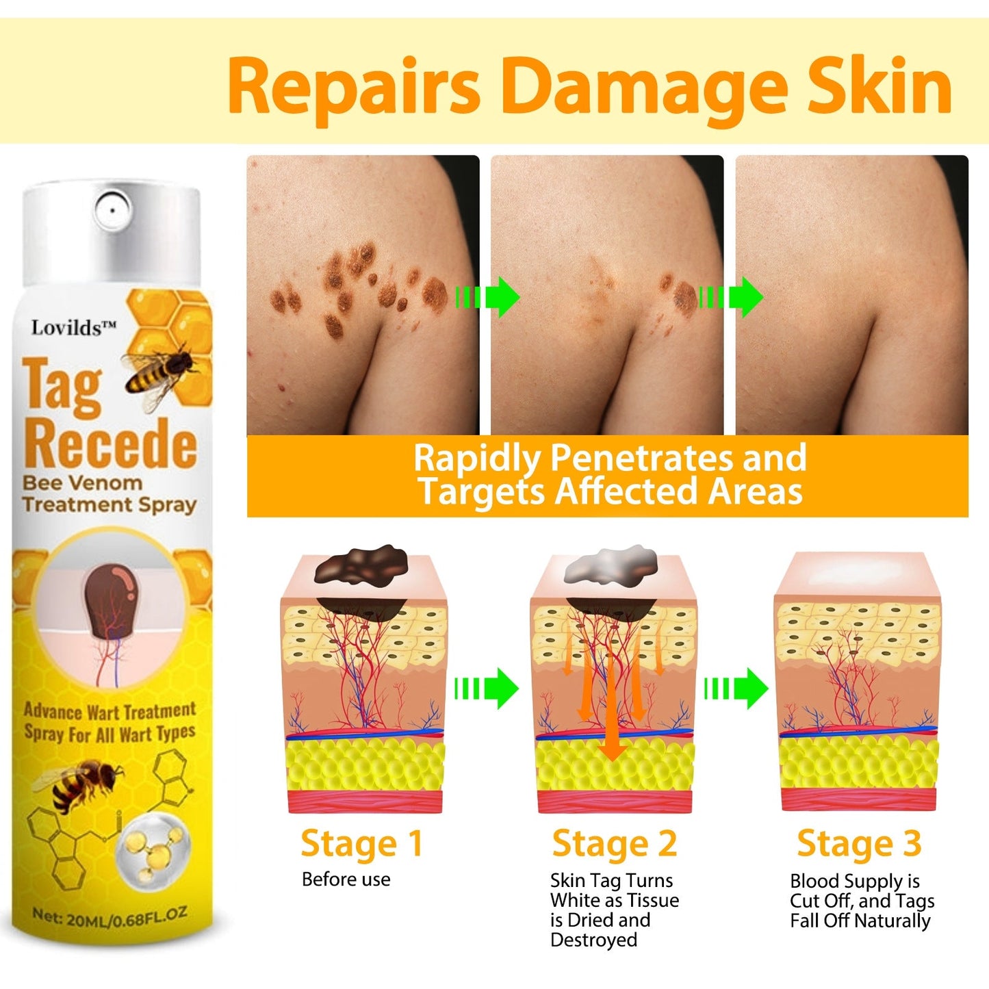 đLOVILDS⢠TagRecede Bee Venom Treatment Spray