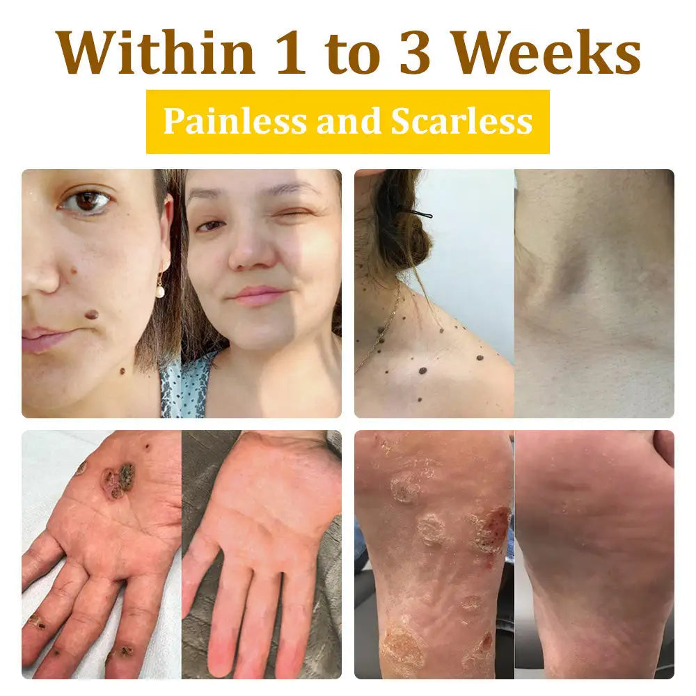 đLOVILDS⢠TagRecede Bee Venom Treatment Spray