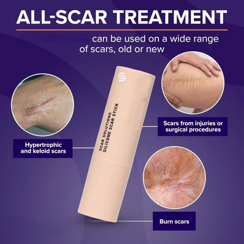 Skin Scar Solutions🛡️ 60% Silicone Scar Stick.