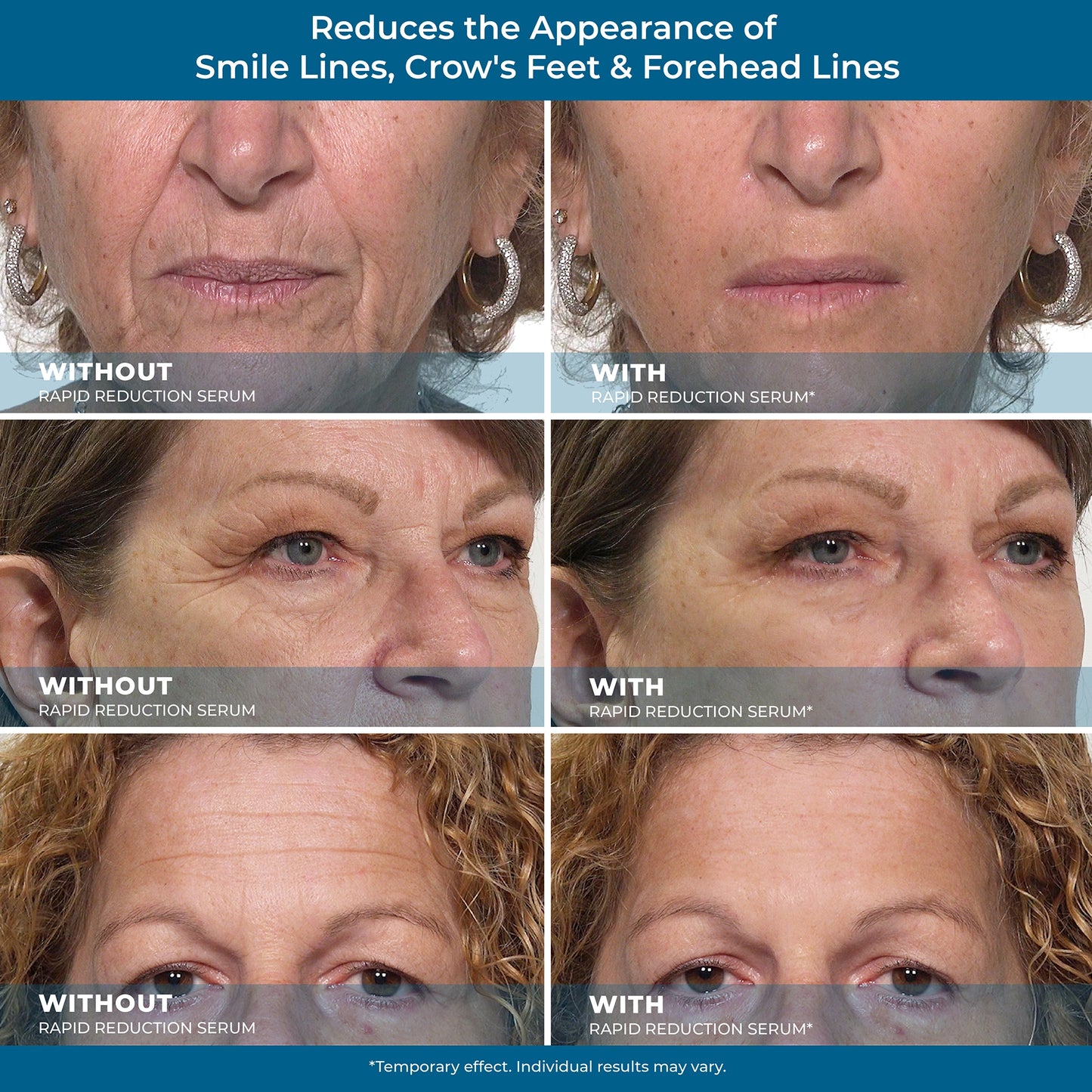 🌟 Prexdren® Rapid Reduction Eye Serum — Instantly reduces eye bags, wrinkles, and dark circles