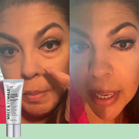 🔥Last Day 49% OFF🔥LOVILDS Instant Eye Lift Firming Cream💕