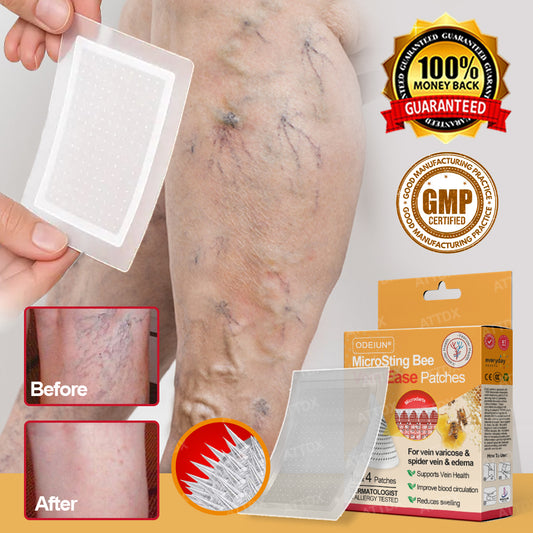 ODEIUN® MicroSting Bee Vein Ease Patches