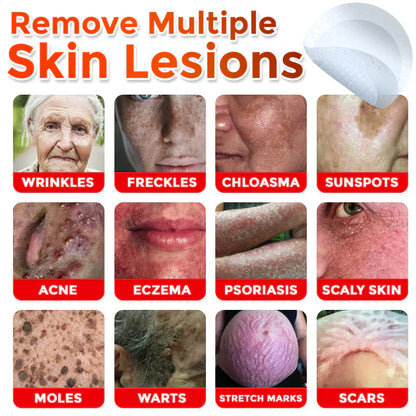 🌈LOVILDS® MicroNeedle Botanic Skin Tag Removal Patch (Made in the USA)